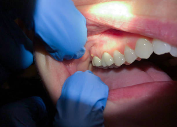 Best Pediatric Emergency Dentist in Chicopee, MA
